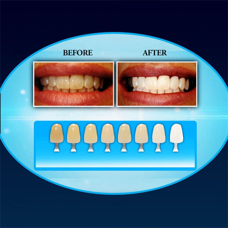 20 Minute Dental Whitening Kit LED Light